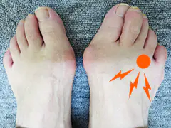 ヘバーデン結節が原因となる足指の「第４指付け根の痛み」