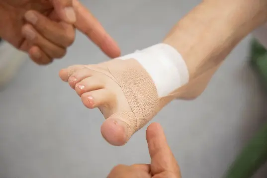 外反母趾・浮き指・足の痛み